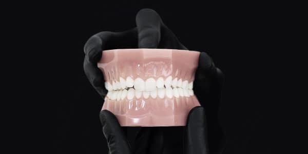 Tratamiento del Bruxismo en Viladecans - Férula de Descarga - Clínica Vela-Segalà