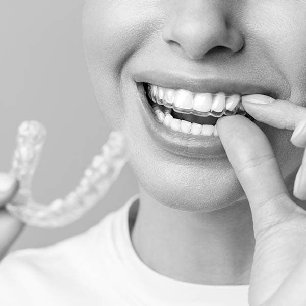 Férulas transparentes de ortodoncia invisible fabricadas a medida