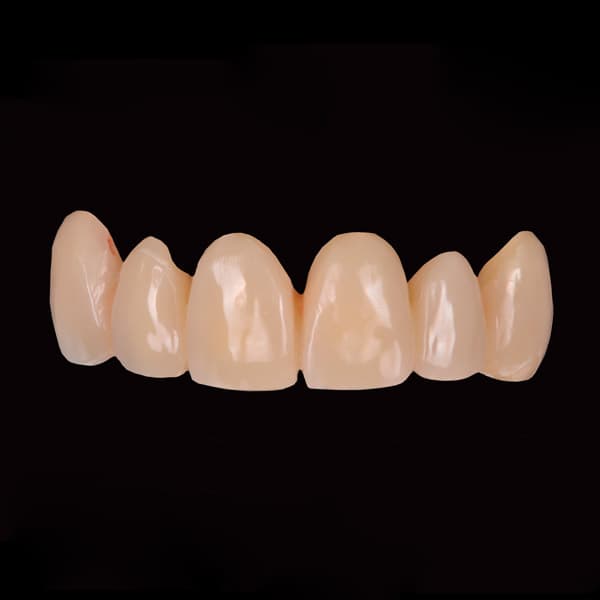 Implantes de carga inmediata - Dientes en el día