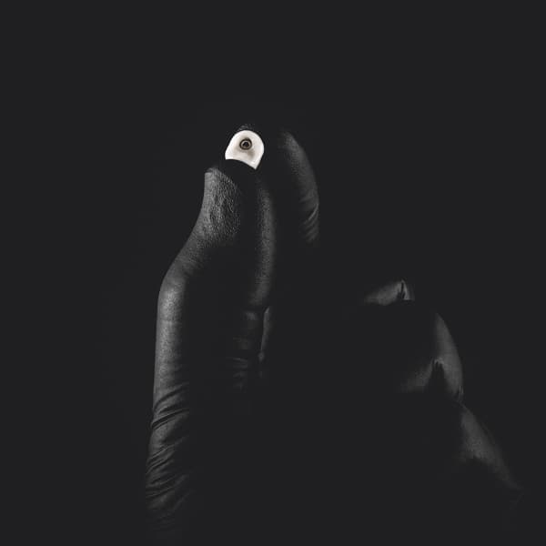 Implantes Dentales en Viladecans - Clínica Vela-Segalà