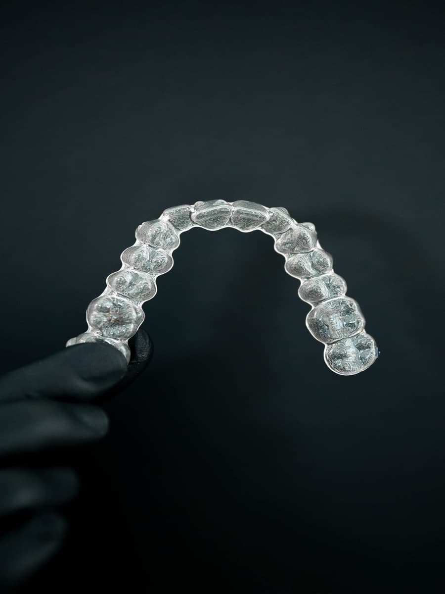 Alineador transparente de ortodoncia invisible en Viladecans - Clínica Vela-Segalà