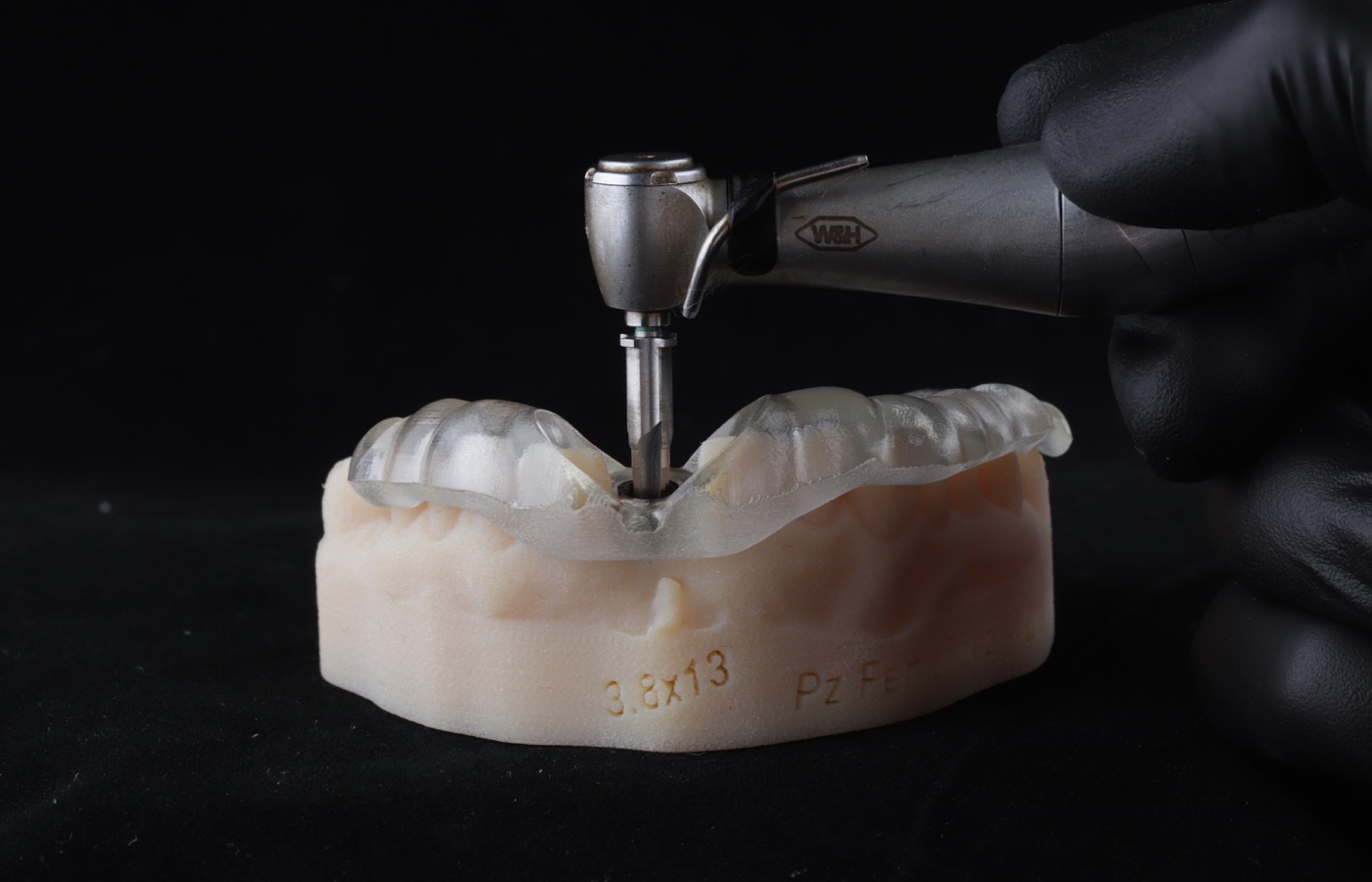 Modelo de implante dental siendo colocado - Clínica Vela-Segalà Viladecans