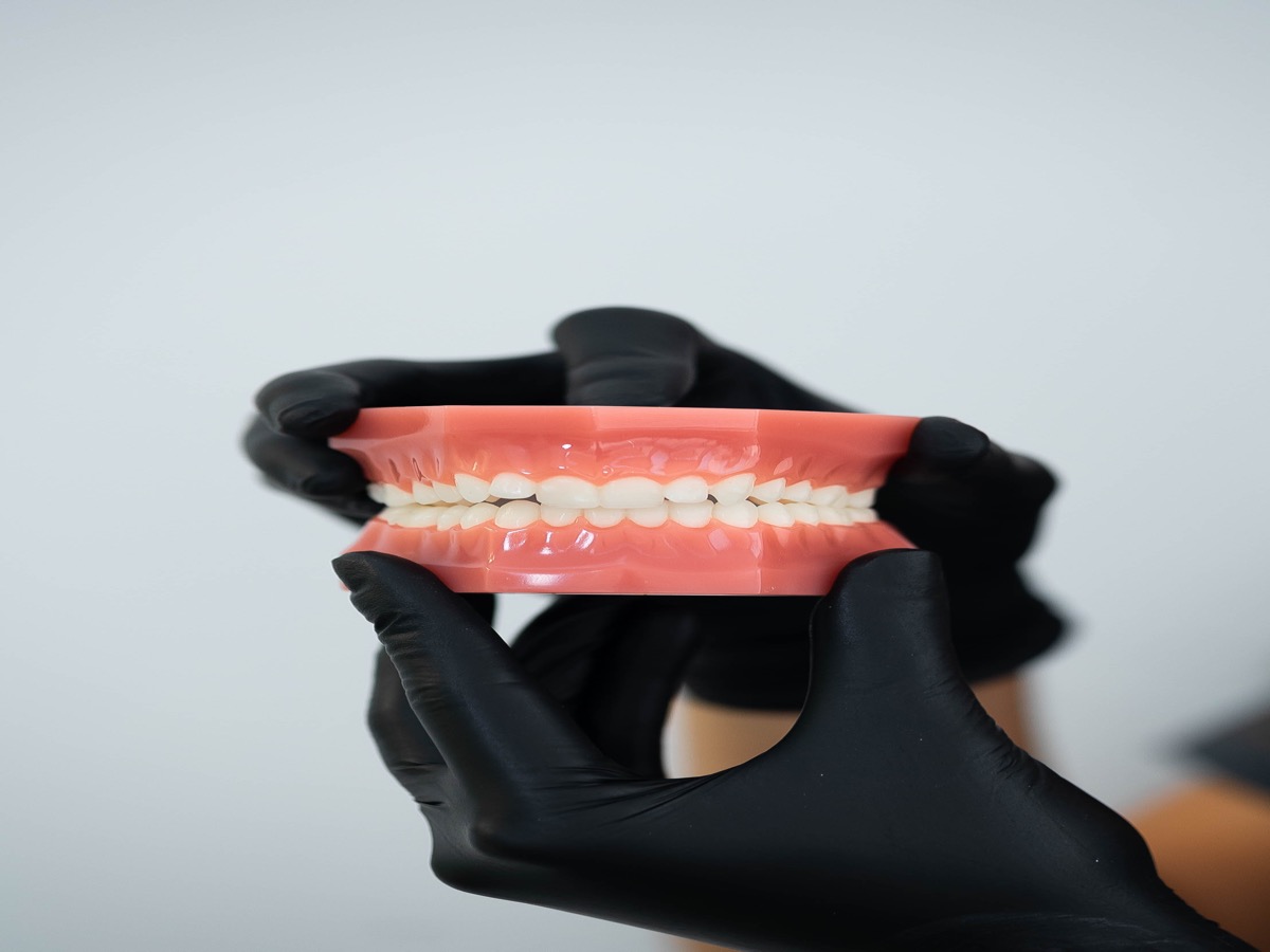 Brackets estéticos y cerámicos - ortodoncia Clínica Vela-Segalà Viladecans