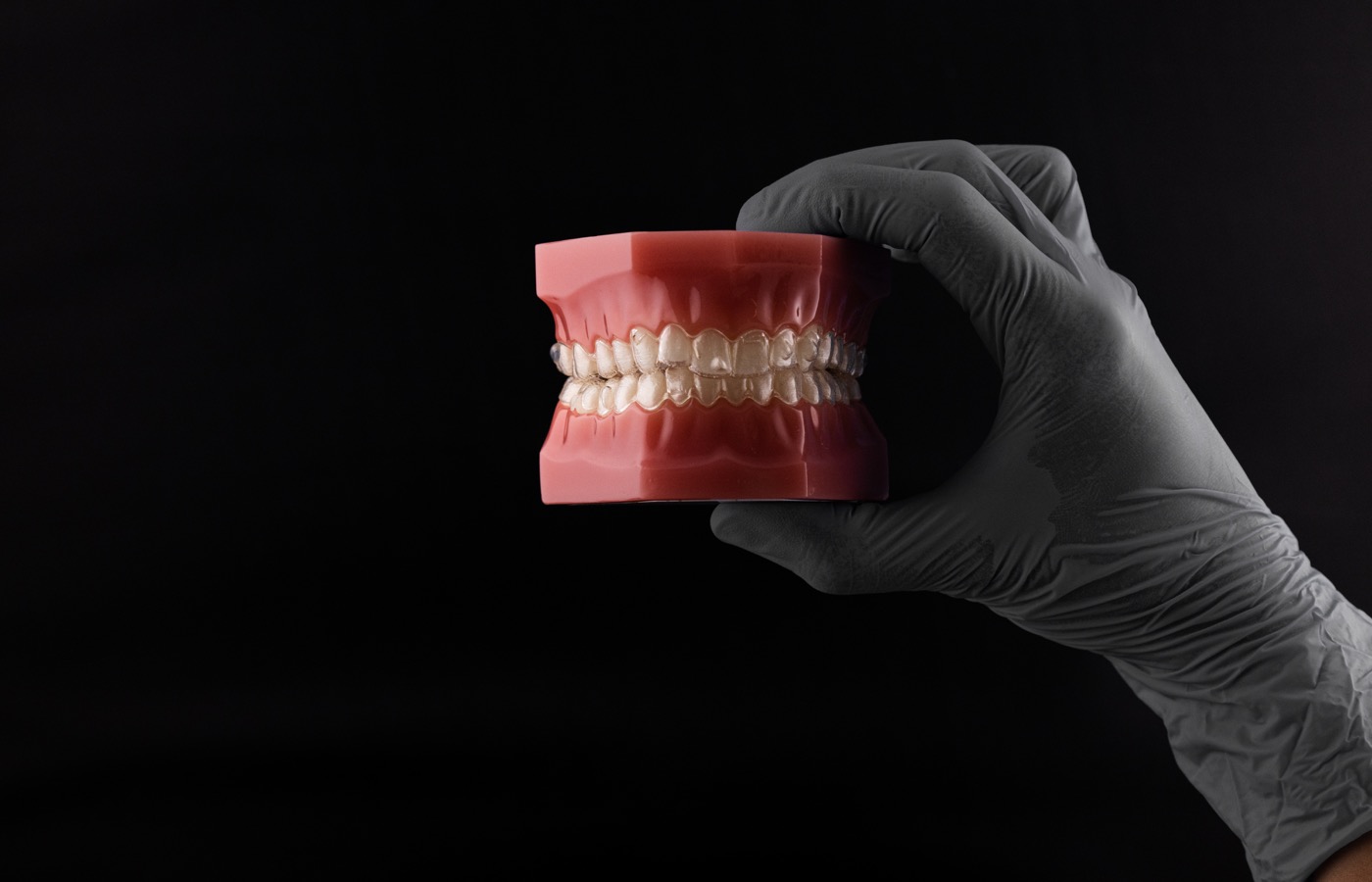 Modelo dental con alineadores invisibles - Clínica Vela-Segalà