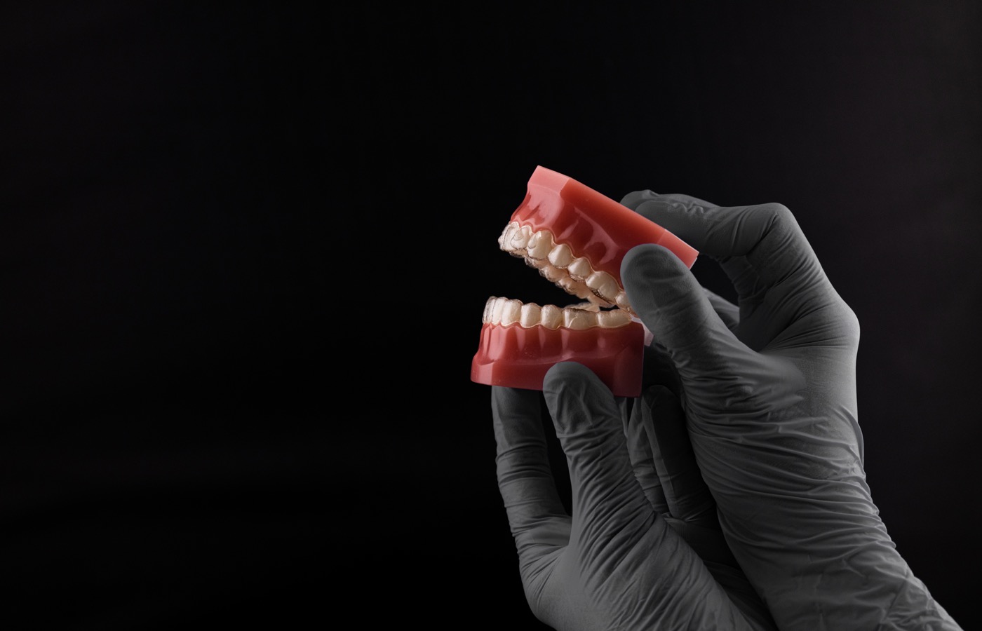 Modelo dental - ortodoncia en Viladecans